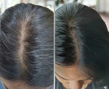 🌿 BUY 1 GET 1 FREE Black Gold Hair Oil  - 100% Working 🌿