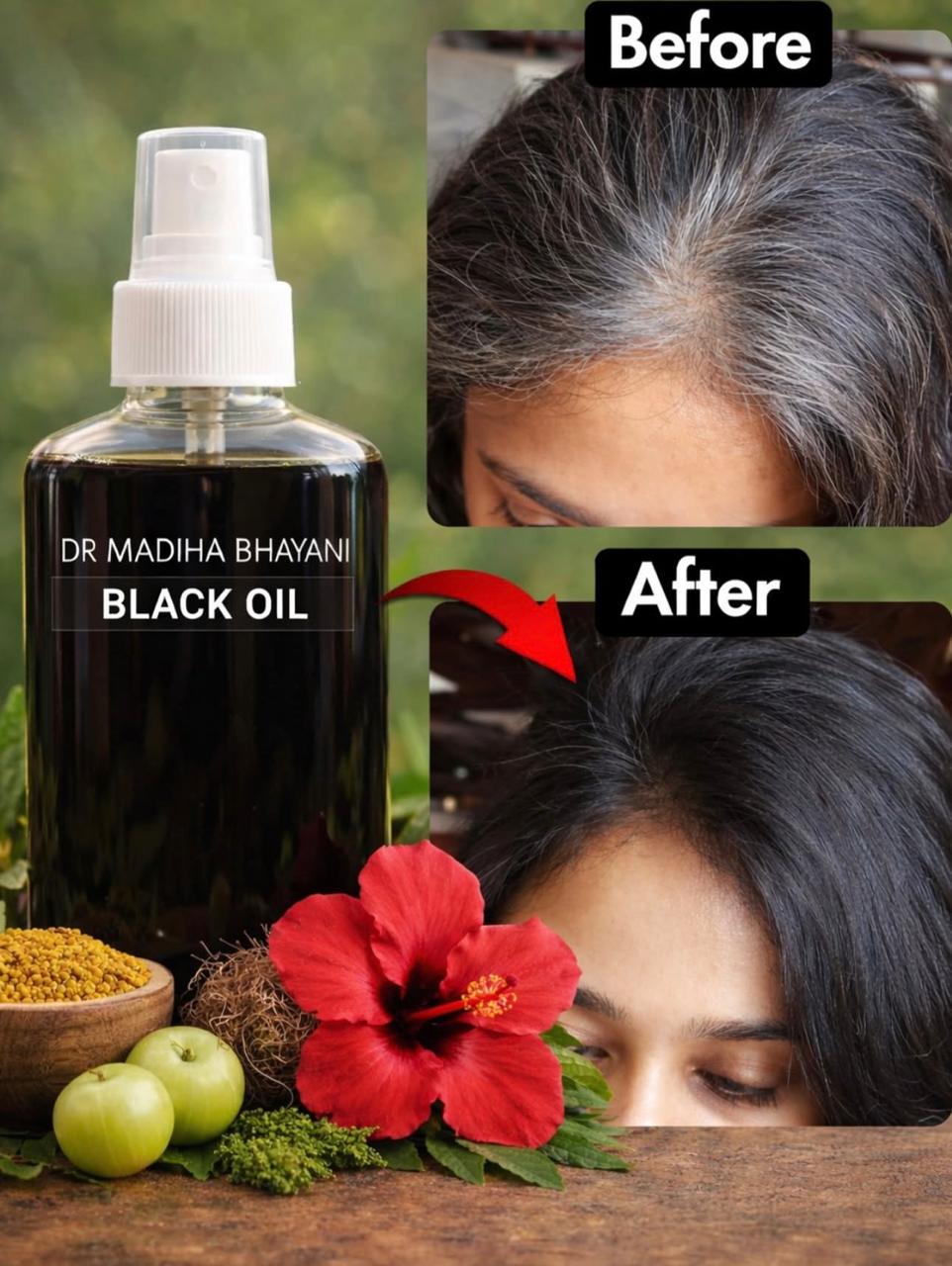 🌿 BUY 1 GET 1 FREE Black Gold Hair Oil  - 100% Working 🌿